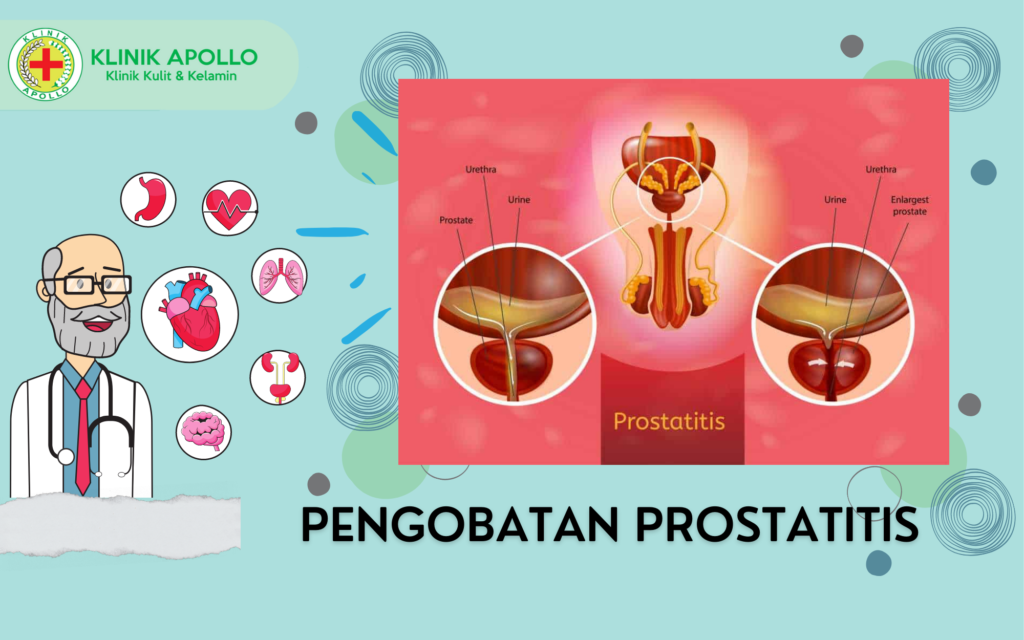 Pengobatan Prostatitis